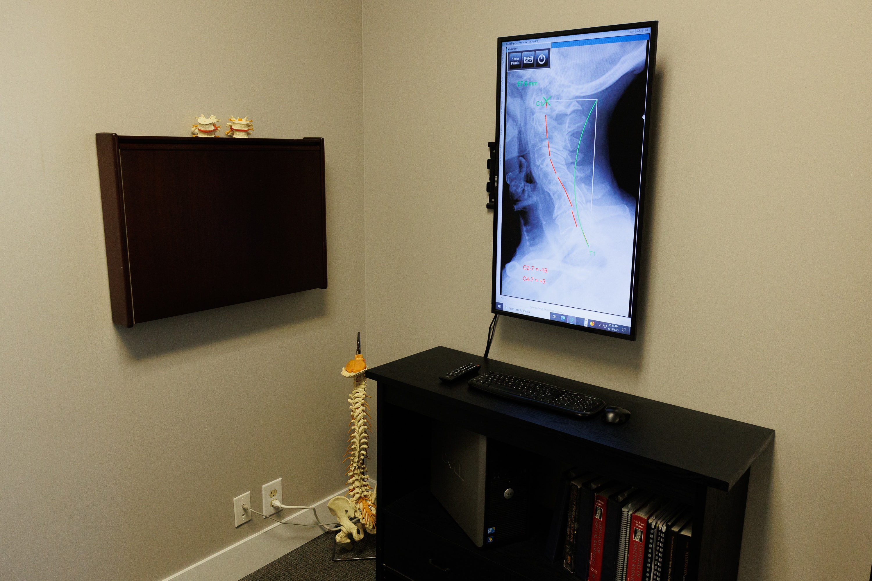 Chiropractor reviewing digital cervical spine X-ray with patient at Omaha Headache Clinic